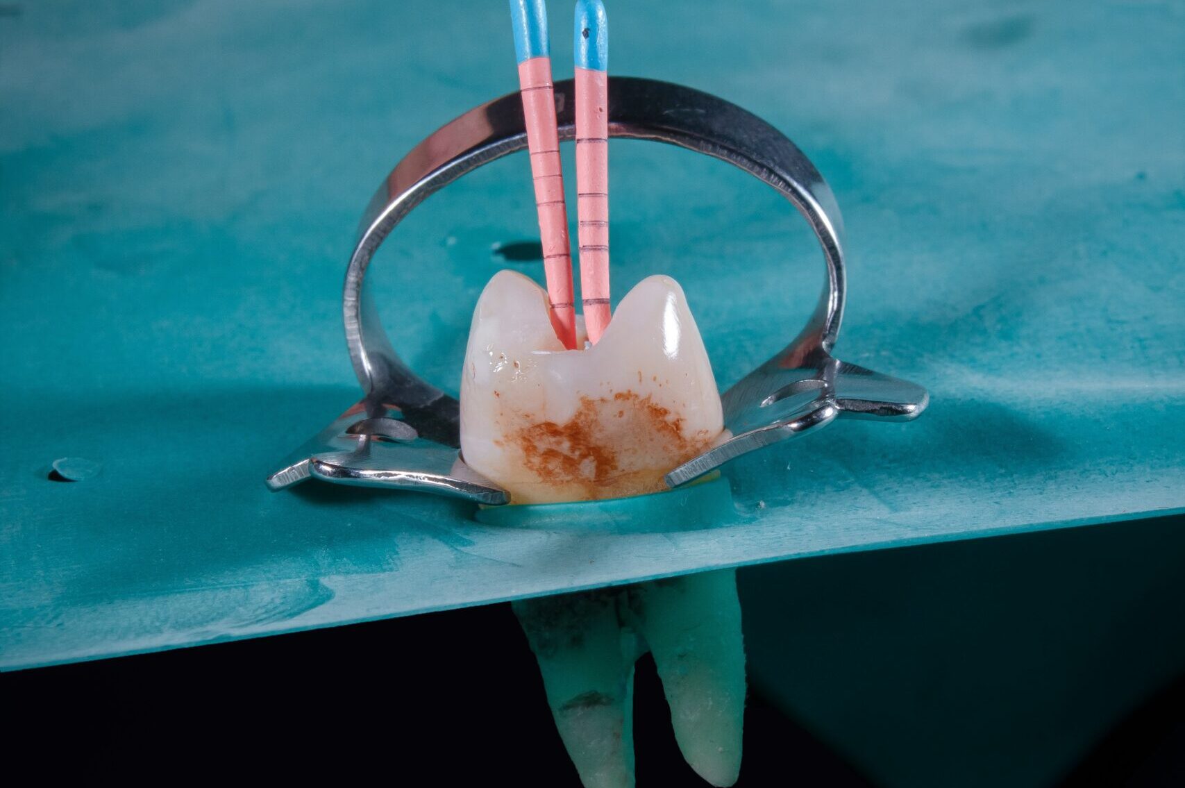 ozkan-guner-LAIE6VYBCO0-unsplash